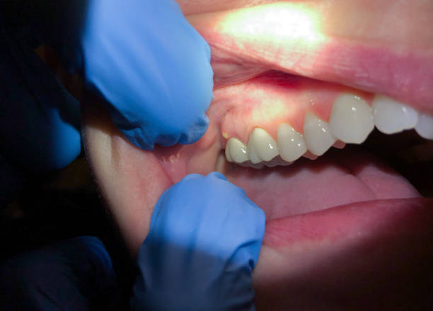 Best Emergency Orthodontic Repairs in Bullard, TX