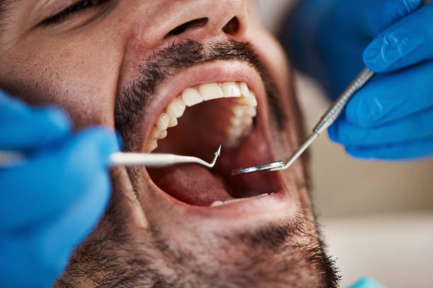 Best Emergency Cosmetic Dentistry (e.g., broken veneers) in Bullard, TX
